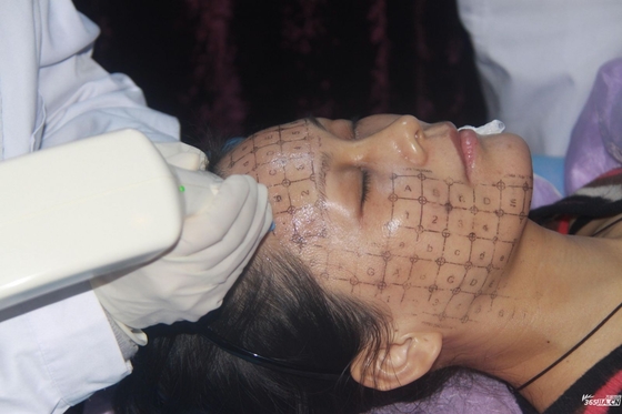 Hot Maggie RF Skin Rejuvenation Machine With 8 Inch Screen Gray Chassis
