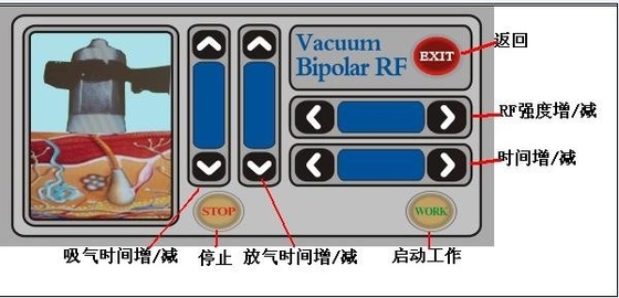 Vertical RF Cavitation Slimming Machine Bipolar With Strong Sound Wave